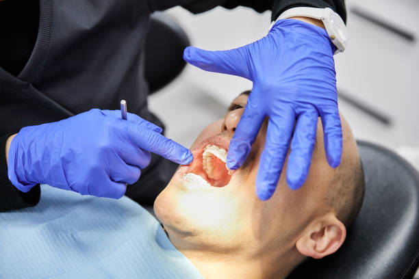 Best Emergency Dentist for Knocked-Out Tooth in Fairview, OK